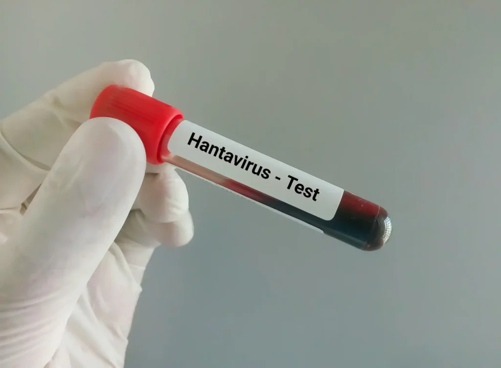 Hantavirus en crucero MV Hondius: protocolos, riesgos reales y respuesta sanitaria en España