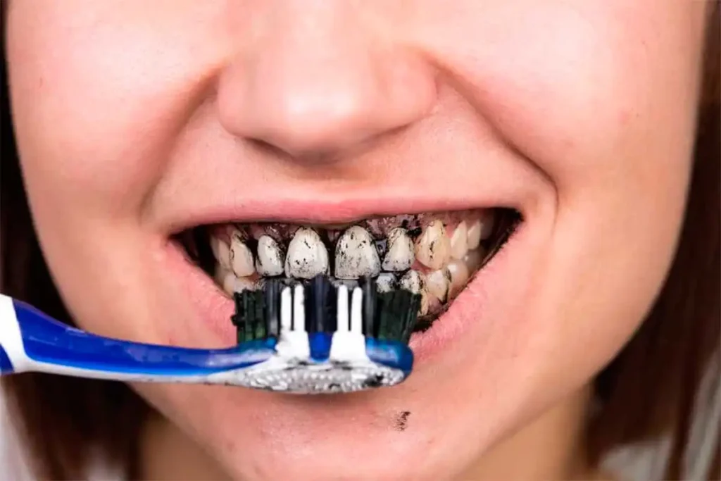 Los Peligros Ocultos de las Pastas de Dientes con Carbón Activo