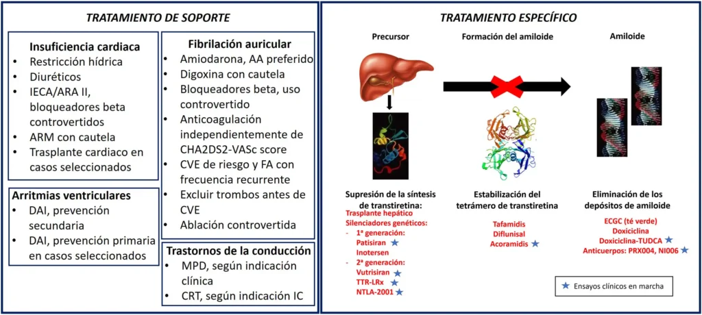 Un Avance Revolucionario en el Tratamiento de la Amiloidosis Cardíaca